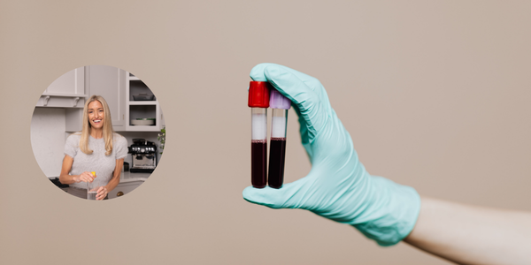 Blood Markers 101: What Your Results Are Really Telling You (and What to Do Next)