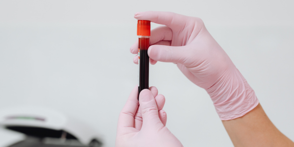 5 Things a Blood Test Can Tell You About Your Sleep